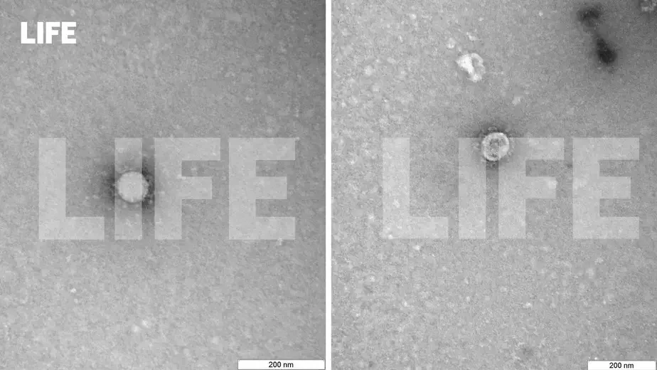 Снимки получены методом негативного контрастирования на просвечивающем электронном микроскопе JEM-1400. Размер частиц — 100—120 нанометров (миллиардная доля метра).